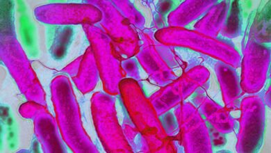 سحب جديد لبراعم الفجل في الولايات المتحدة بسبب E. coli والسالمونيلا.. FDA توسع تحذيراً غذائياً